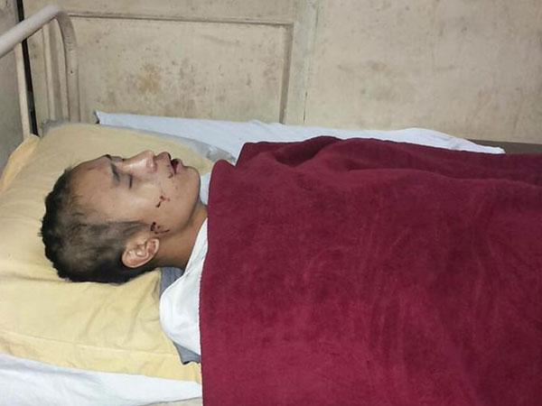 গুরগাঁও: ন্যাড়া করে নাগাল্যান্ডের ২ কিশোরকে নির্মম মার দুষ্কৃতীদের গুরগাঁও: ন্যাড়া করে নাগাল্যান্ডের ২ কিশোরকে নির্মম মার দুষ্কৃতীদের