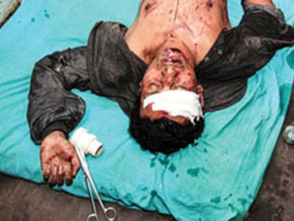 অভিষেককে চড় মারায় খুনের চেষ্টার মামলা দেবাশিস আচার্যর বিরুদ্ধে! অভিষেককে চড় মারায় খুনের চেষ্টার মামলা দেবাশিস আচার্যর বিরুদ্ধে!