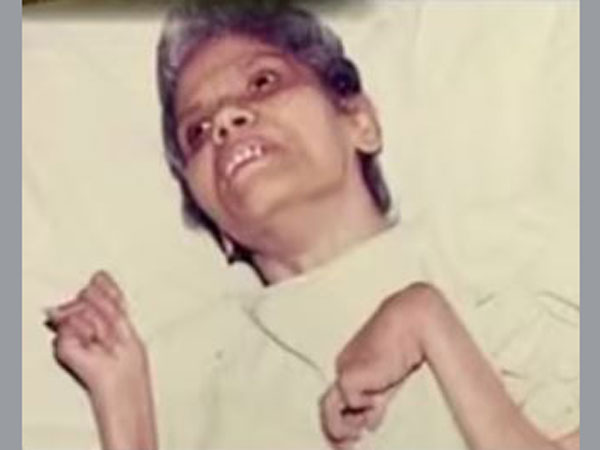 ৪২ বছর কোমায় থাকার পর মৃত্যু হল মুম্বইয়ের ধর্ষিতা নার্স অরুণা সানবওগের ৪২ বছর কোমায় থাকার পর মৃত্যু হল মুম্বইয়ের ধর্ষিতা নার্স অরুণা সানবওগের
