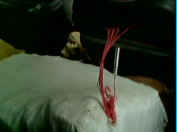 ডিটোনেটর