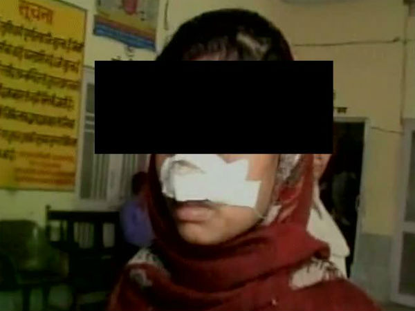 আক্রমণ