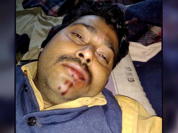 তৃণমূল বিজেপি সংঘর্ষে রণক্ষেত্র জোড়াবাগান তৃণমূল বিজেপি সংঘর্ষে রণক্ষেত্র জোড়াবাগান