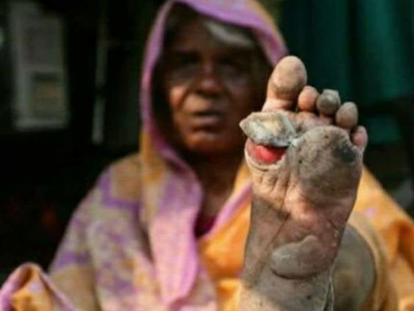 ওড়িশায় কৃষক অসন্তোষ