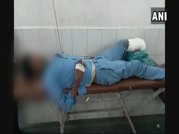 বালিশ হিসেবে কাটা পা ! যোগীর রাজ্যের সরকারি হাসপাতালের কাজে চাঞ্চল্য বালিশ হিসেবে কাটা পা ! যোগীর রাজ্যের সরকারি হাসপাতালের কাজে চাঞ্চল্য