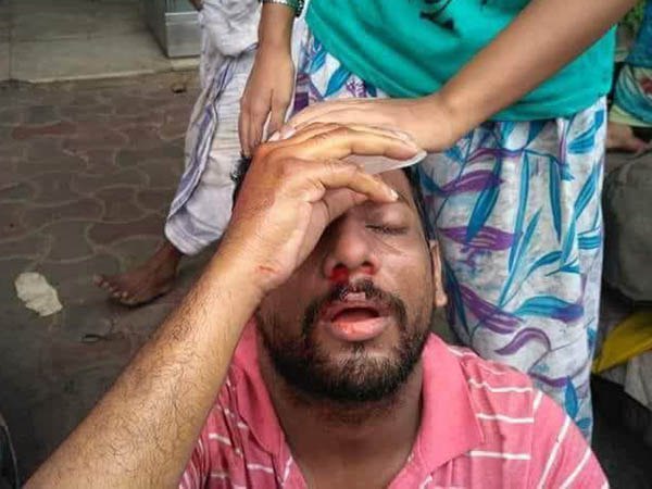 মোদীর শিক্ষানীতি ও ভর্তি দুর্নীতির প্রতিবাদ! আক্রান্ত যাদবপুর-প্রেসিডেন্সির পড়ুয়ারা মোদীর শিক্ষানীতি ও ভর্তি দুর্নীতির প্রতিবাদ! আক্রান্ত যাদবপুর-প্রেসিডেন্সির পড়ুয়ারা