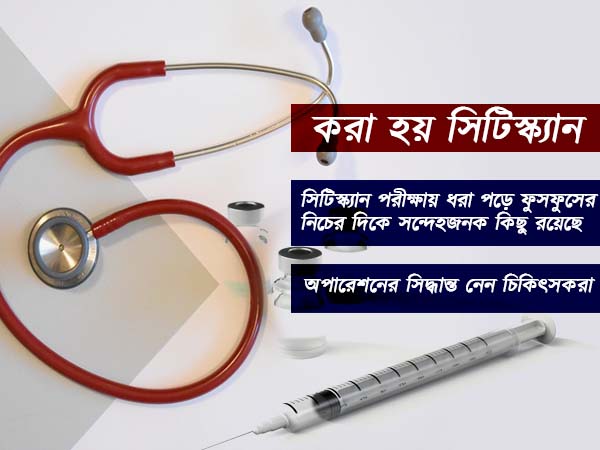 করা হয় সিটিস্ক্যান