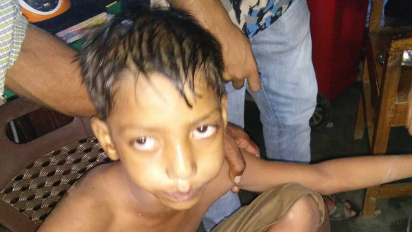 মহরমের লাঠি খেলার সময় দুষ্কৃতীদের গুলিতে জখম বালক মহরমের লাঠি খেলার সময় দুষ্কৃতীদের গুলিতে জখম বালক