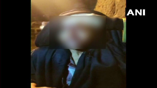 আহত হয়েছেন এক অধ্যাপিকাও