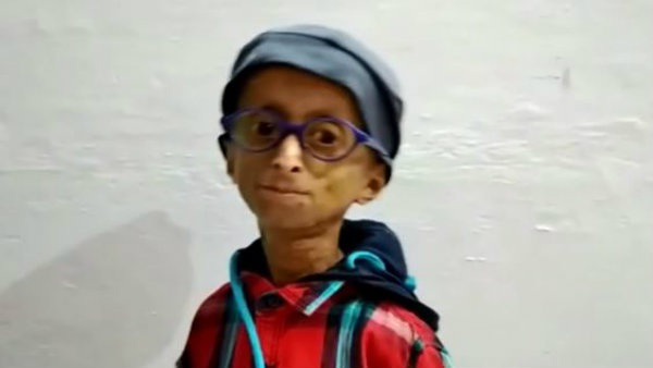 করোনা কি অ্যায়সি ত্যায়সি, বাড়িতে থেকে সুরক্ষিত থাকার পরামর্শ প্রোজেরিয়া শিশুদের করোনা কি অ্যায়সি ত্যায়সি, বাড়িতে থেকে সুরক্ষিত থাকার পরামর্শ প্রোজেরিয়া শিশুদের