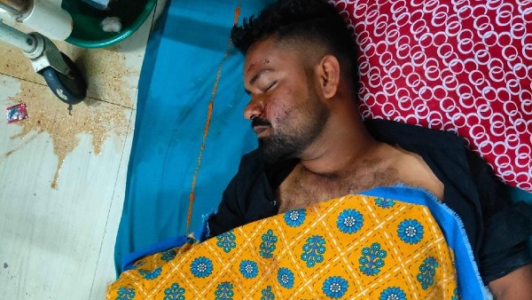 সকালে হাত গেল কুকুরের মুখে