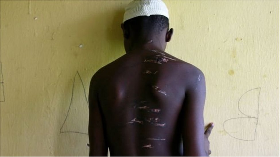 ১৫ বছর বয়সী এই কিশোর দেখাচ্ছেন কিভাবে তাকে প্রহার করা হয়েছে ১৫ বছর বয়সী এই কিশোর দেখাচ্ছেন কিভাবে তাকে প্রহার করা হয়েছে